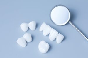 Porcelain Veneers in Lexington, Kentucky