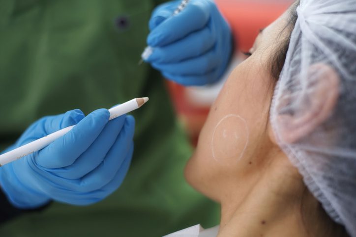 Botox for teeth grinding issues